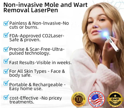 👩🏻‍⚕️Clinically Reviewed by Mayo Clinic Experts: Nuogea Non-invasive CO2 Mole and Wart Removal Laser Pen Promax (Fast and painless removal of warts, moles, age spots, and skin tags completely without side effects.)