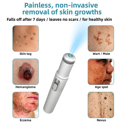 👩🏻‍⚕️Clinically Reviewed by Mayo Clinic Experts: Nuogea Non-invasive CO2 Mole and Wart Removal Laser Pen Promax (Fast and painless removal of warts, moles, age spots, and skin tags completely without side effects.)