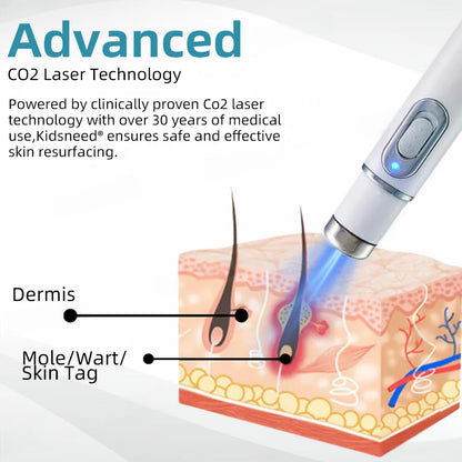 👩🏻‍⚕️Clinically Reviewed by Mayo Clinic Experts: Nuogea Non-invasive CO2 Mole and Wart Removal Laser Pen Promax (Fast and painless removal of warts, moles, age spots, and skin tags completely without side effects.)