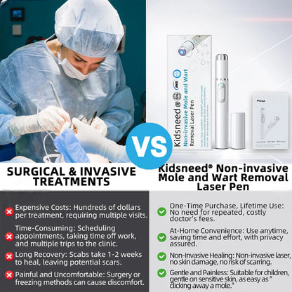👩🏻‍⚕️Clinically Reviewed by Mayo Clinic Experts: Nuogea Non-invasive CO2 Mole and Wart Removal Laser Pen Promax (Fast and painless removal of warts, moles, age spots, and skin tags completely without side effects.)